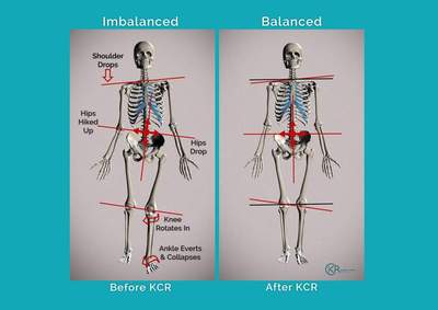 Kinetic Chain Release (KCR)